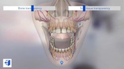 Dental Simulator screenshot 4