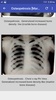 Musculoskeletal X- Rays Interpretation screenshot 6