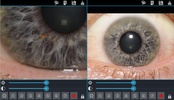 Eye Diagnosis screenshot 4