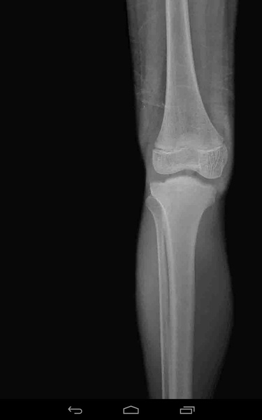 X-ray Cam Prank - Preview 5