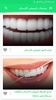 وصفات لتبييض الأسنان وتقويتها screenshot 9