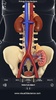 Urinary System screenshot 13