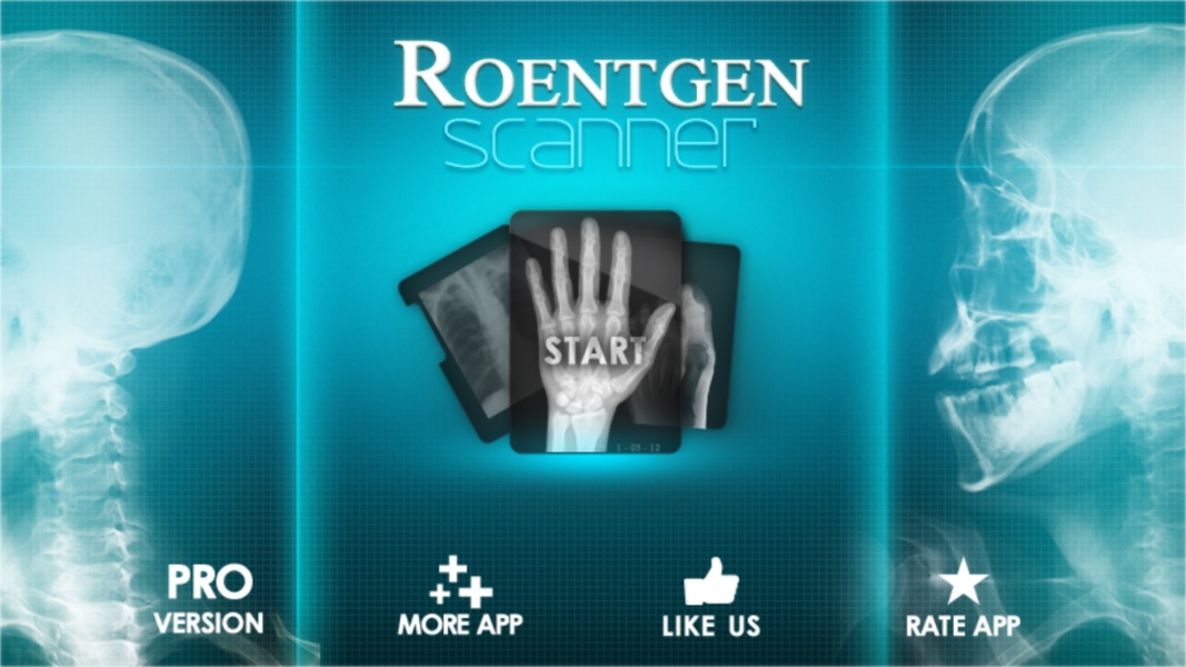 X-Ray Scanner: Augmented Prank - Preview 3