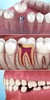 Dental 3D Illustrations screenshot 17