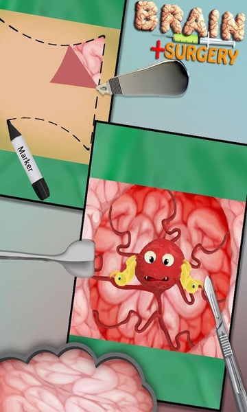 BrainSurgery - Preview 2
