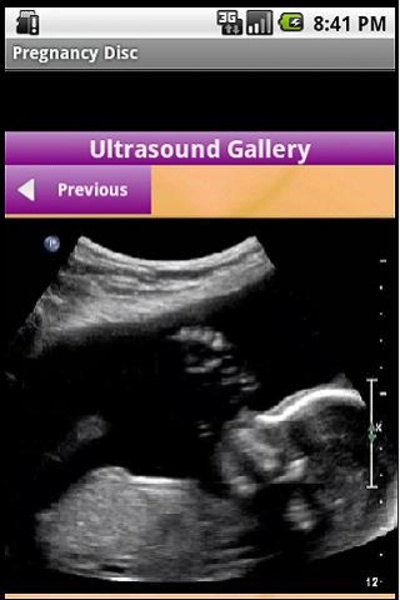 Pregnancy Disc - Preview 6