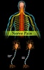 Nerve Pain screenshot 6
