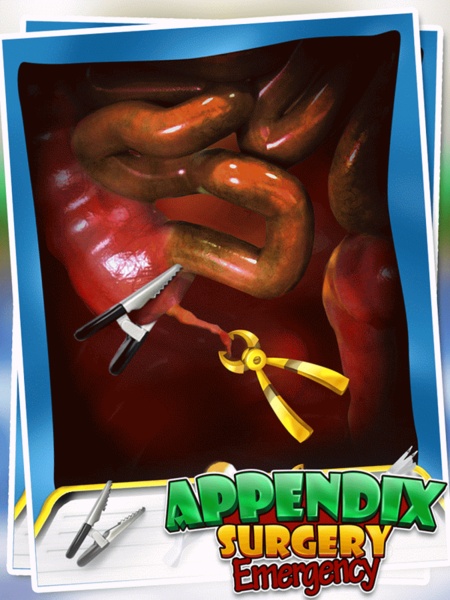 Appendix Surgery - Preview 4