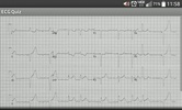 ECG_Quiz screenshot 3