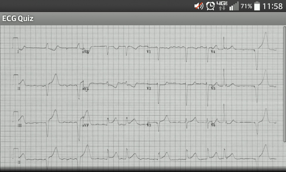 ECG_Quiz - Preview 3