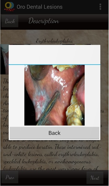 Oro Dental Lesions - Preview 3