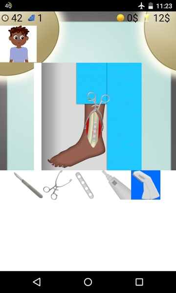 Ankle Surgery - Preview 4