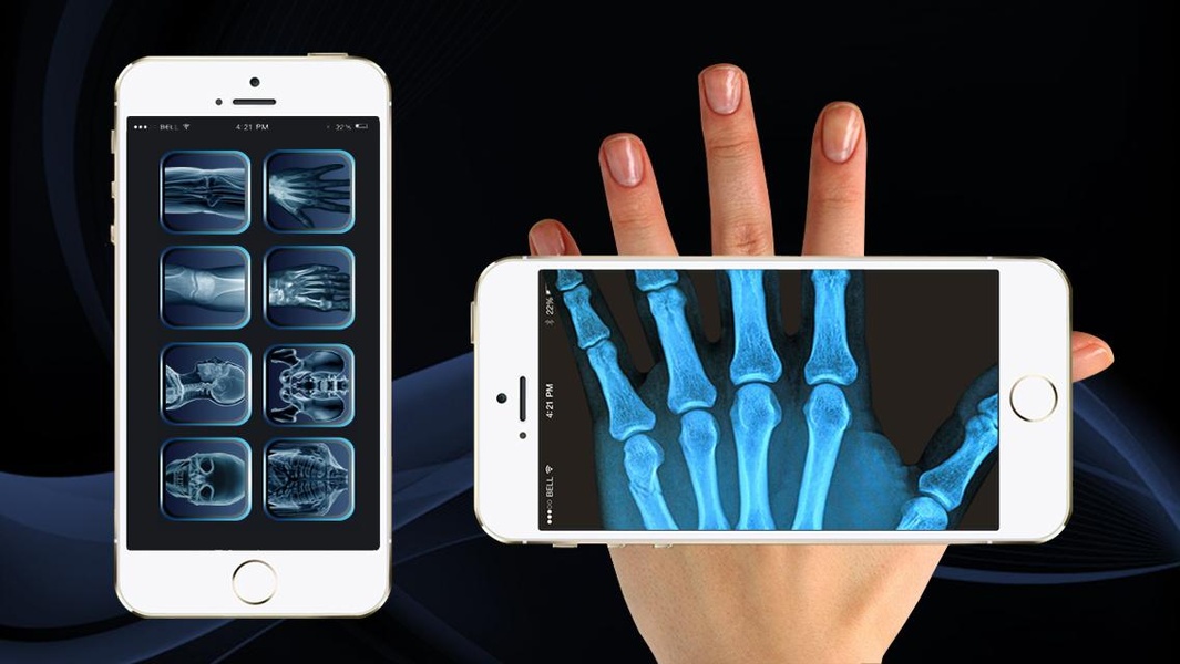 Xray Scan 2 - Preview 6