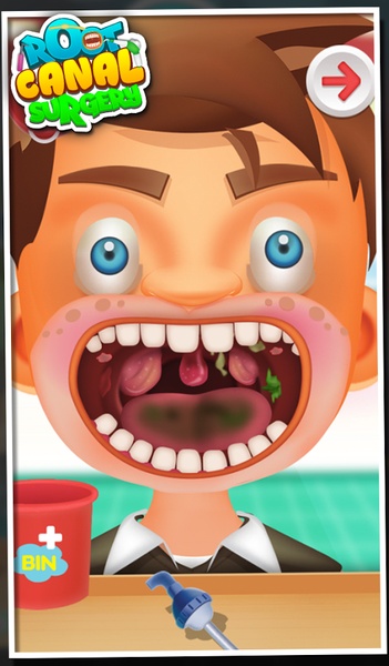 Root Canal Surgery - Preview 5