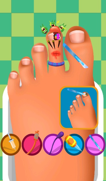 Feet Nails Doctor - Preview 1