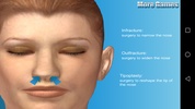 Nose Doctor screenshot 7