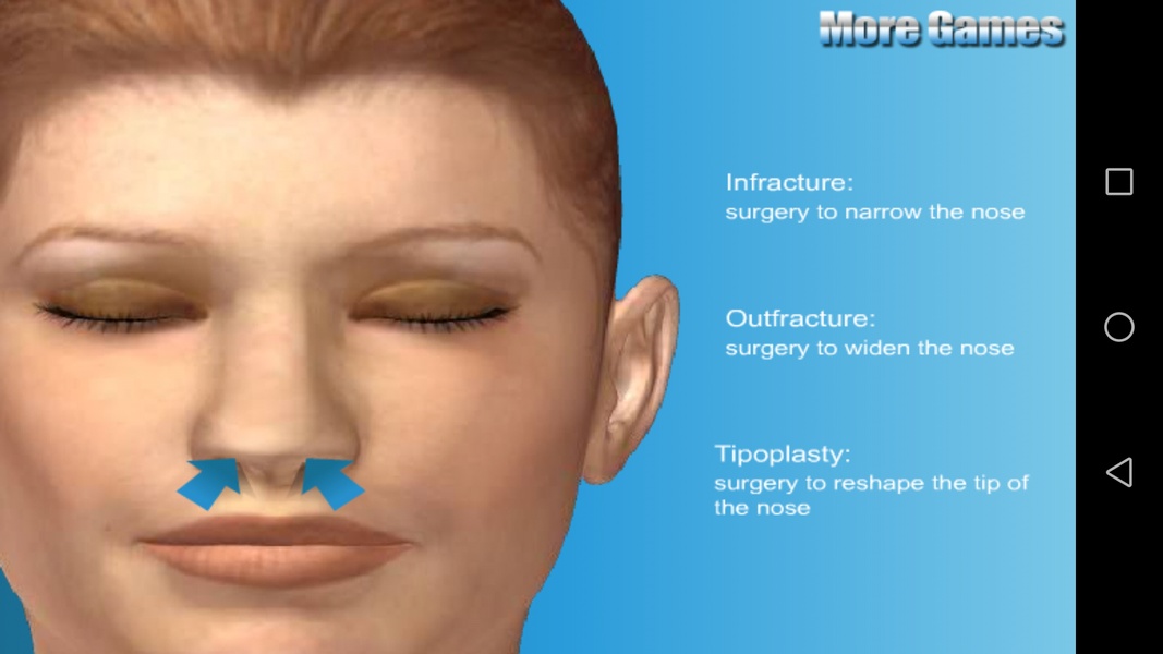 Nose Doctor - Preview 7