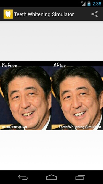 Teeth Whitening Simulator - Preview 1