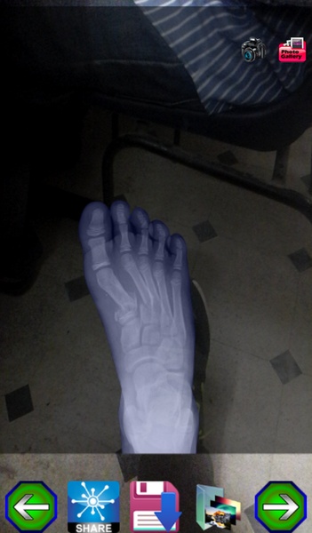Xray Camera Scan - Preview 2