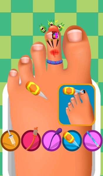 Feet Nails Doctor - Preview 3