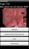 Dermadroid screenshot 2