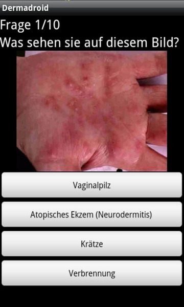 Dermadroid - Preview 2