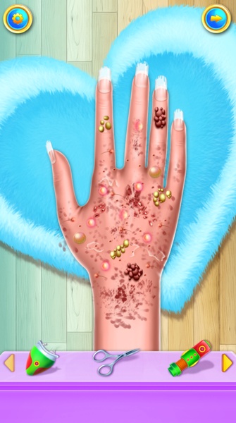 Hand Skin Doctor - Preview 9