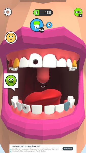 Dentist Bling - Preview 8