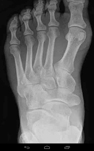 X-ray Cam Prank - Preview 1