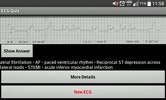 ECG_Quiz screenshot 1