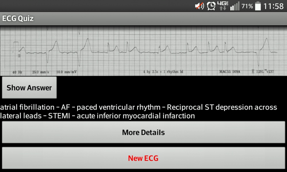 ECG_Quiz - Preview 1