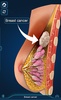 Breast Anatomy Pro. screenshot 7