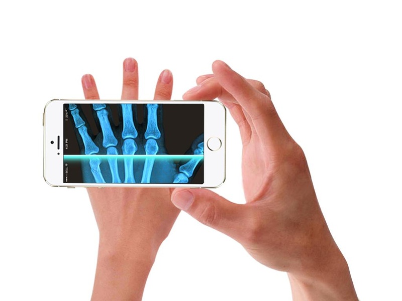 Xray Scan 2 - Preview 5