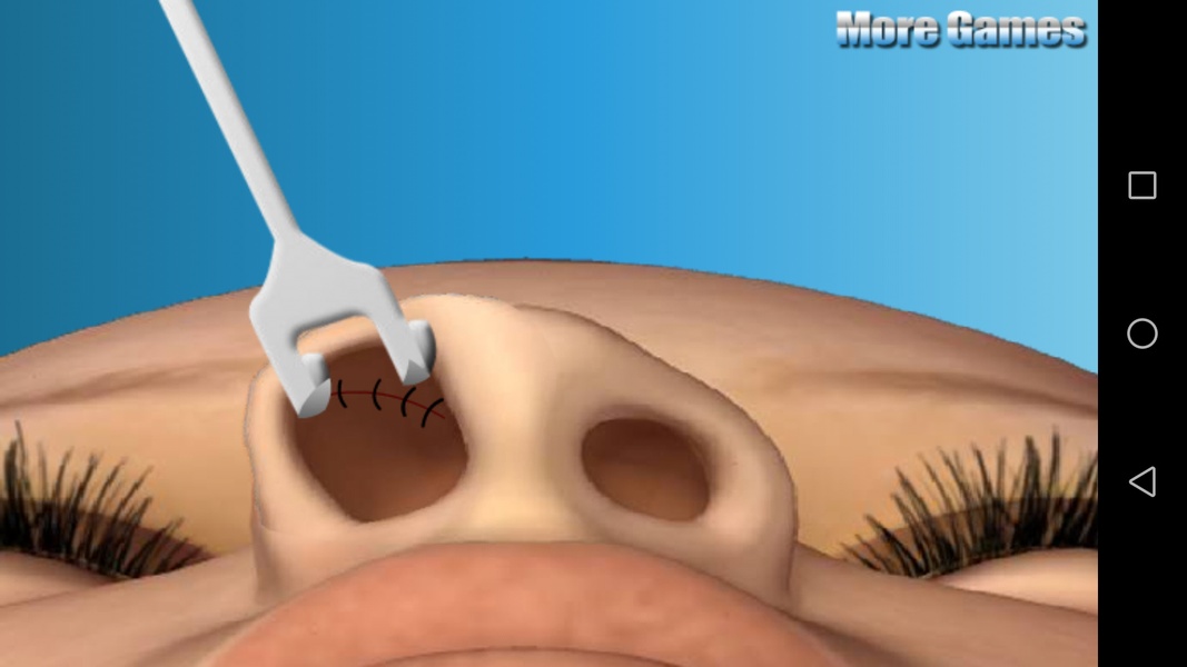 Nose Doctor - Preview 2