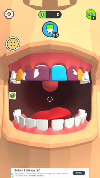 Dentist Bling - Preview 1