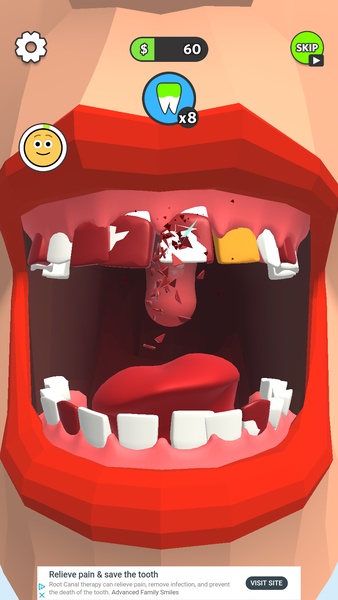Dentist Bling - Preview 3