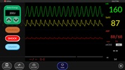 Simpl - Simulated Patient Monitor screenshot 2