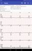 aECG screenshot 5