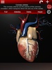 Circulatory System in 3D (Anatomy) screenshot 13