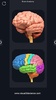 My Brain Anatomy screenshot 9