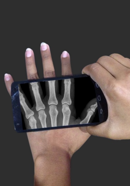 X Ray Scanner Pro - Preview 2