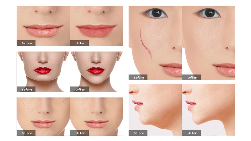 PhotoPlasticSurgeryProfessional - Preview 2