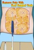 Liposuction Surgery Simulator screenshot 1