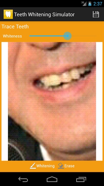 Teeth Whitening Simulator - Preview 2