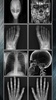 X-Ray Body Scanner screenshot 3