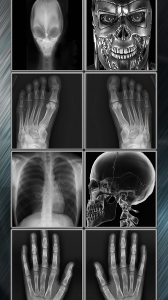 X-Ray Body Scanner - Preview 2
