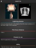 RX - Radiographic Positioning screenshot 2