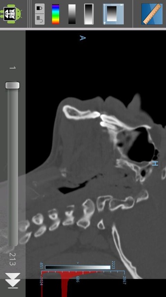 Droid Dicom Viewer - Preview 2