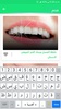 وصفات لتبييض الأسنان وتقويتها screenshot 1