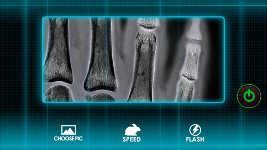 X-Ray Scanner: Augmented Prank - Preview 2